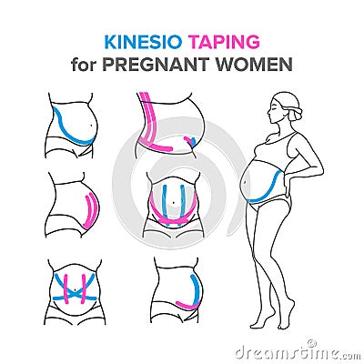 Kinesio taping for pregnant women Vector Illustration