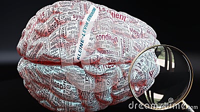 Kleine levin syndrome in human brain Stock Photo