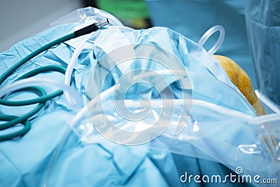 Knee arthroscopy orthopedic surgery operation Stock Photo