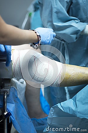 Knee arthroscopy orthopedic surgery operation Stock Photo