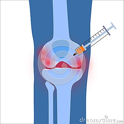 Knee Injection concept Vector Illustration