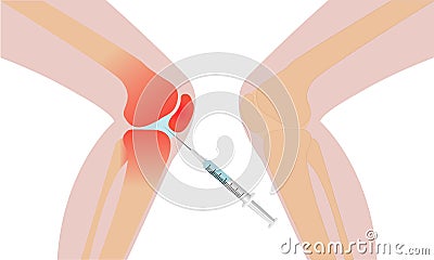 Knee injection inflamation redness vector illustration Vector Illustration