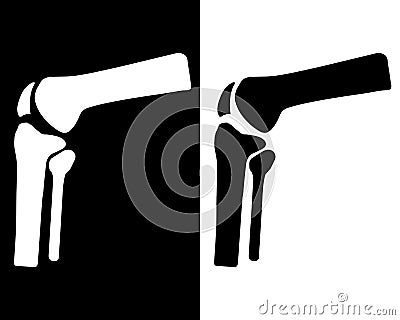 Knee, knee injury, medicine, orthopedics, bone, joint. Flat design, Vector Illustration