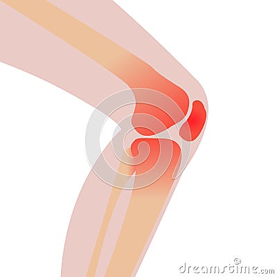 Knee injury Vector Illustration