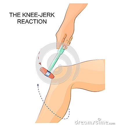 The knee-jerk reflex Vector Illustration