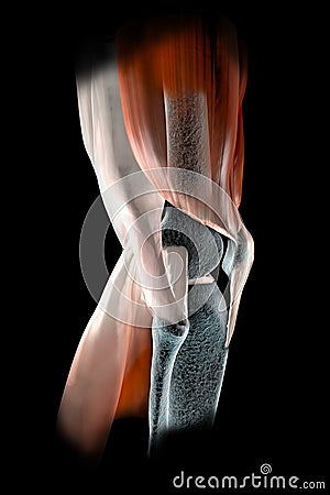 Knee ligaments, tendons, bones, muscles x-ray Stock Photo