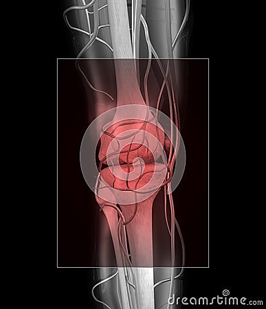 Knee and Muscle Pain Stock Photo