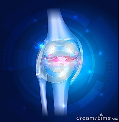Knee Osteoarthritis abstract blue background Vector Illustration
