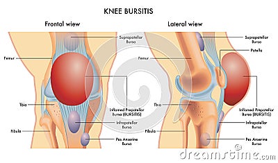 Knee pain Vector Illustration