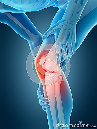 Knee pain Cartoon Illustration