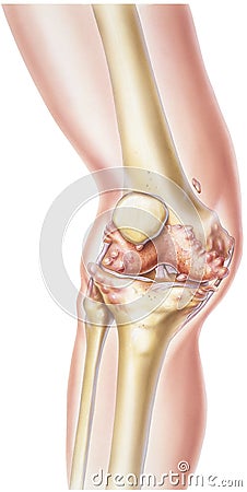 Knee - Rheumatoid Arthritis Stock Photo