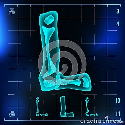 L Letter Vector. Capital Digit. Roentgen X-ray Font Light Sign. Medical Radiology Neon Scan Effect. Alphabet. 3D Blue Vector Illustration