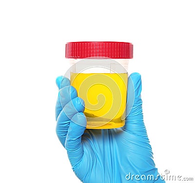 Laboratory assistant holding container with urine sample for analysis on white background Stock Photo