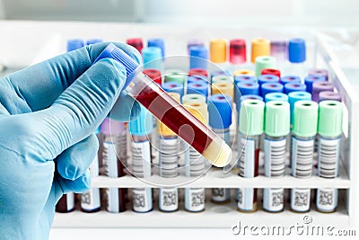 Laboratory technician holding a blood tube test Stock Photo