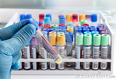 Laboratory technician holding a blood tube test labeled with bar Stock Photo