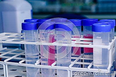 Laboratory test tubes in rack. Concept of science, laboratory and study of diseases. Coronavirus COVID-19 treatment developing Stock Photo