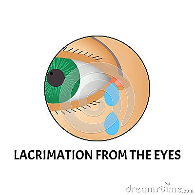 Lacrimation from the eyes. Symptom of conjunctivitis, allergies, inflammation of the eyes. Eye watering icon Vector Illustration