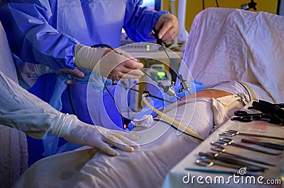 Laparoscopic surgery operation Stock Photo