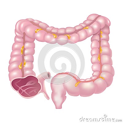 The large intestine, also called the colon, is part of the final Stock Photo