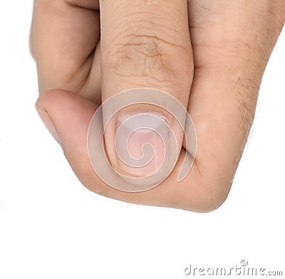 Large lunulae or half-moon at thumb fingernail with longitudinal lines of Southeast Asian, young man. Isolated on white Stock Photo