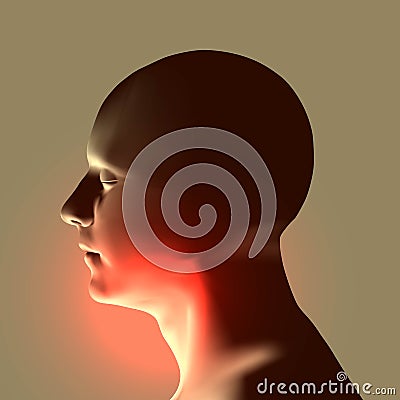 Laryngitis vector illustration. Human throat irritation. Vector Illustration