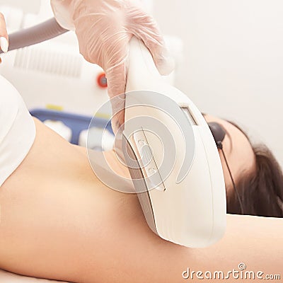 Laser elos medical device. Remove unwanted hair and asteriks. Cosmetology spa procedure at salon. Amprit epilation Stock Photo