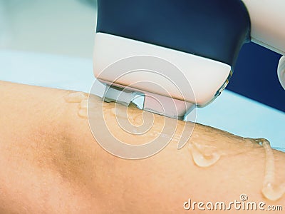 Laser hair arm removal epilation. Treatment in cosmetic salon. Stock Photo