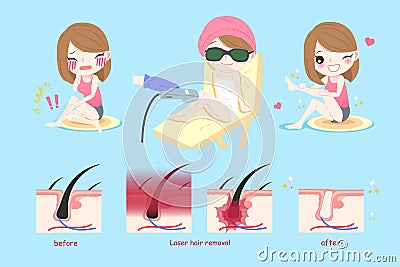 Laser leg hair concept Stock Photo