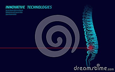 Laser physiotherapy human spine injury. Pain area surgery operation modern loin medicine technology low poly triangles Vector Illustration