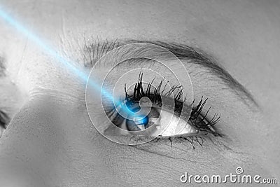 Laser Vision Correction Stock Photo