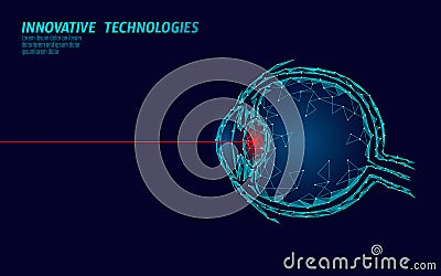 Laser vision correction medicine operation concept. Innovation technology health care. Eye 3D low poly polygonal Vector Illustration