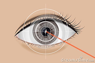 Of laser vision correction. Vector Illustration