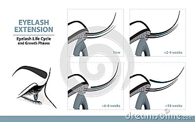 Lash Extension Life Cycle. How Long Do Eyelash Extensions Stay On. Side View. Infographic Vector Vector Illustration