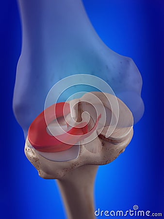 The lateral meniscus Cartoon Illustration