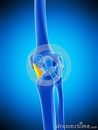 The lateral patellar ligament Cartoon Illustration