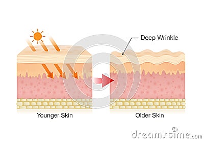 Layer of normal skin and cancer cell spreading in vector style. Vector Illustration