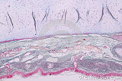 Learning anatomy and physiology of Pseudostratified columnar epithellum under the microscopic. Stock Photo