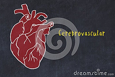 Concept of learning cardiovascular system. Chalk drawing of human heart and inscription Cerebrovascular Stock Photo