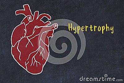 Learning cardio system concept. Chalk drawing of human heart and inscription Hypertrophy Stock Photo