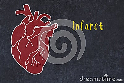 Learning cardio system concept. Chalk drawing of human heart and inscription Infarct Stock Photo