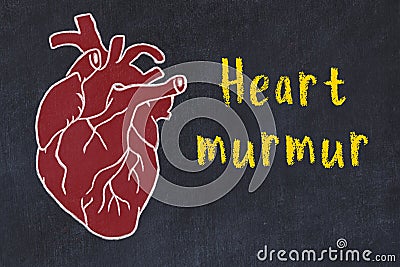 Learning cardio system concept. Chalk drawing of human heart and inscription Heart murmur Stock Photo