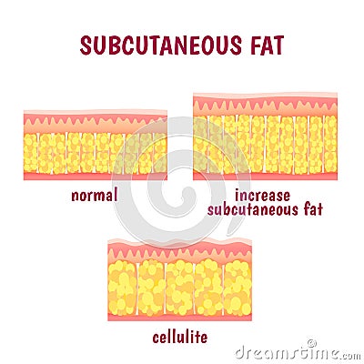 Leather sectional layer of subcutaneous fat Vector Illustration