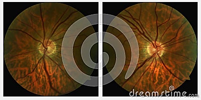 Left and right Eye scans Stock Photo