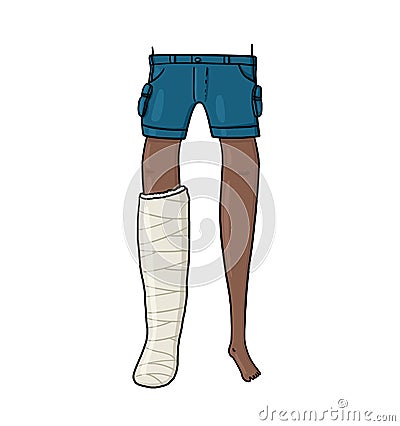 Front view of dark skin leg in cast illustration Cartoon Illustration