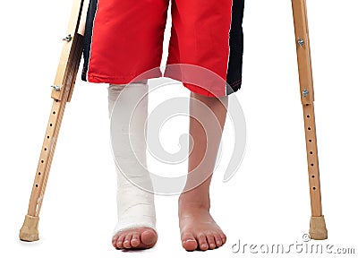 Leg fracture Stock Photo