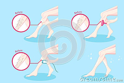 Leg hair removal concept Stock Photo