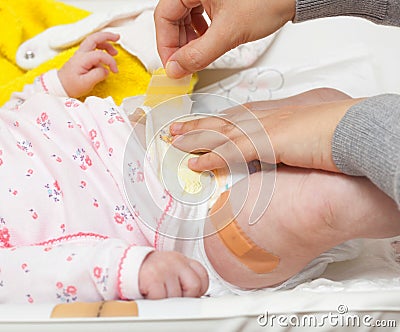 Leg of a newborn with the patch after vaccination. Stock Photo