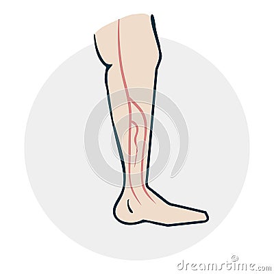 Leg with varicose veins Stock Photo