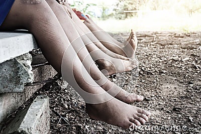Legs of a kids, Stock Photo