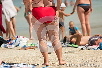 Legs of overweight lady. Stock Photo